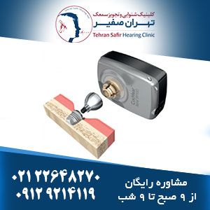 کاشت سمعک گوش