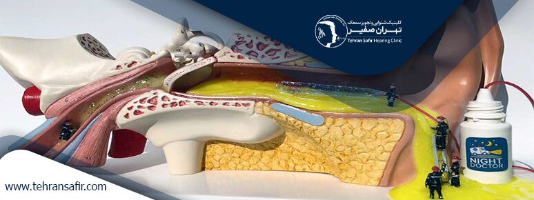 عفونت گوش خارجی