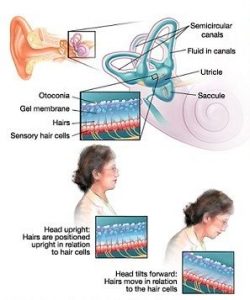 علت سرگیجه و عدم تعادل | ارزیابی اختلال تعادل