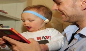 درمان میکروتیا