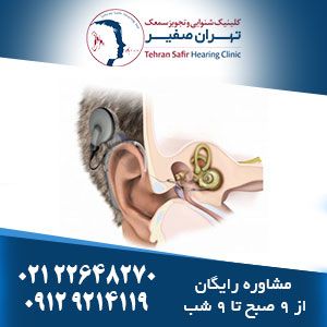 جراحی میکروتیا چیست؟