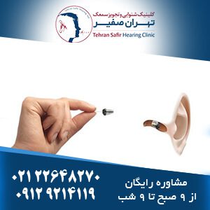 قیمت سمعک مخفی