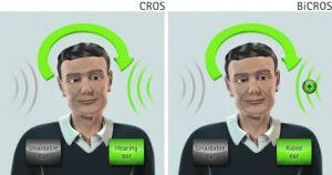 قیمت سمعک کراس