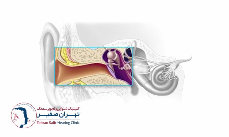 سمعک هوشمند شارژی یا باتری خور؟ کدام بهتر است؟