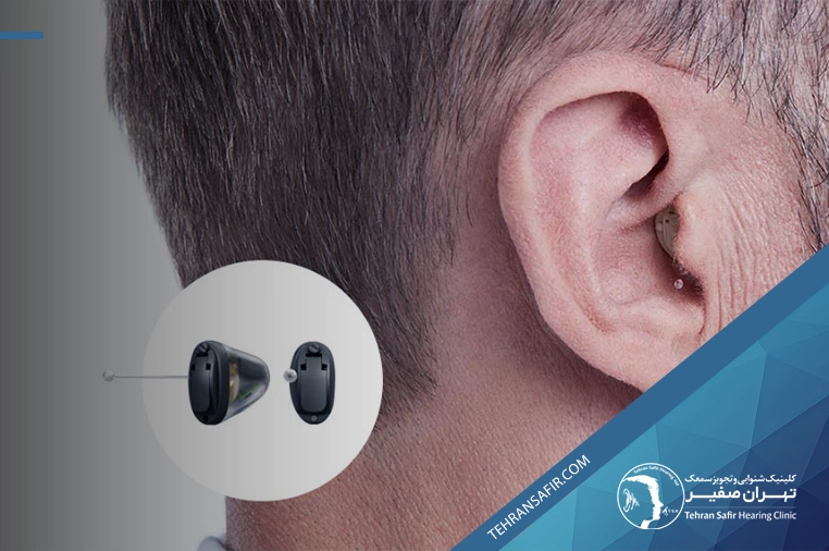 سمعک نامرئی یا پشت گوشی؟