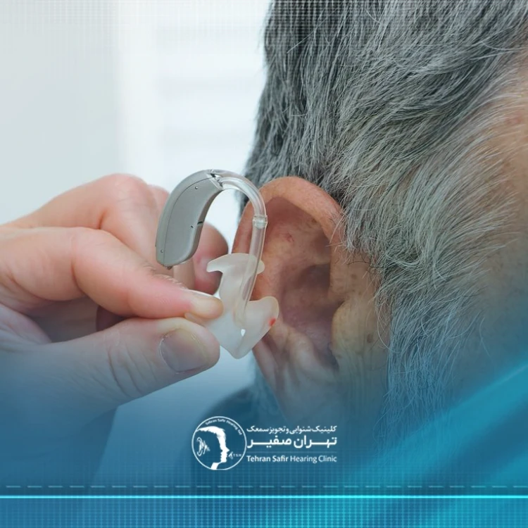 خرید سمعک در تهران
